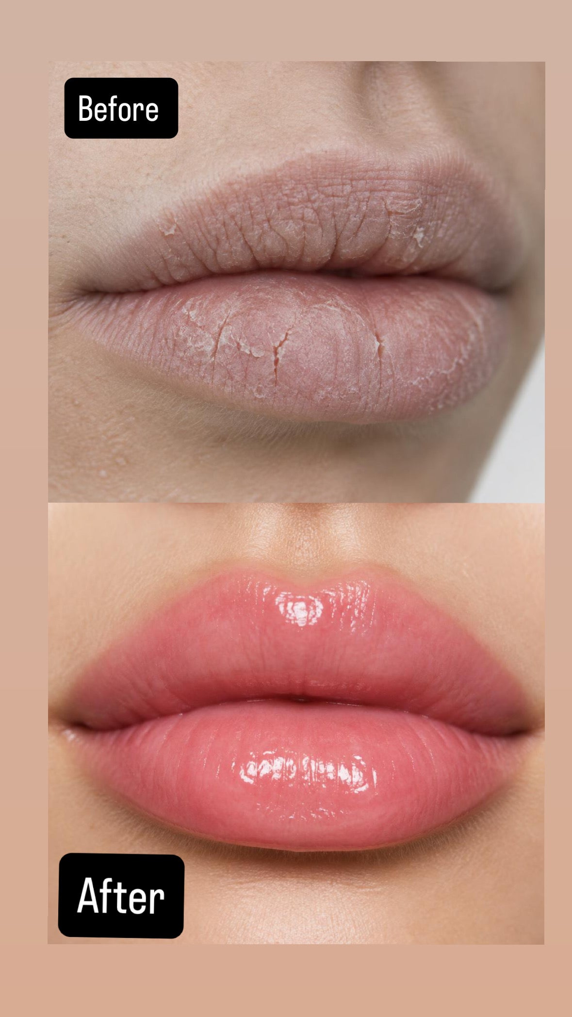Moisturizing Lip Sleeping Mask – Hydrating Lip Care
